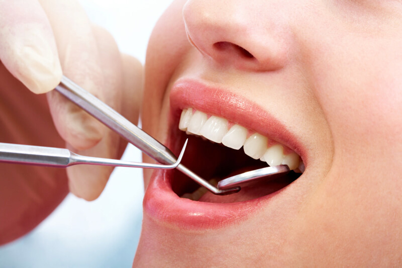 Cô gái đang được bác sĩ dùng gương nha kiểm tra răng