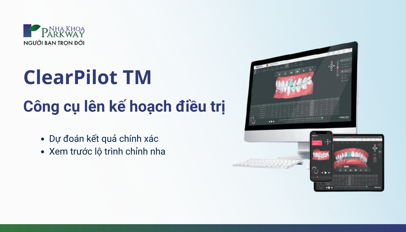 ClearPilot TM-Công cụ lên kế hoạch điều trị: Đự đoán kết quả chính xác, Xem trước lộ trình chỉnh nha