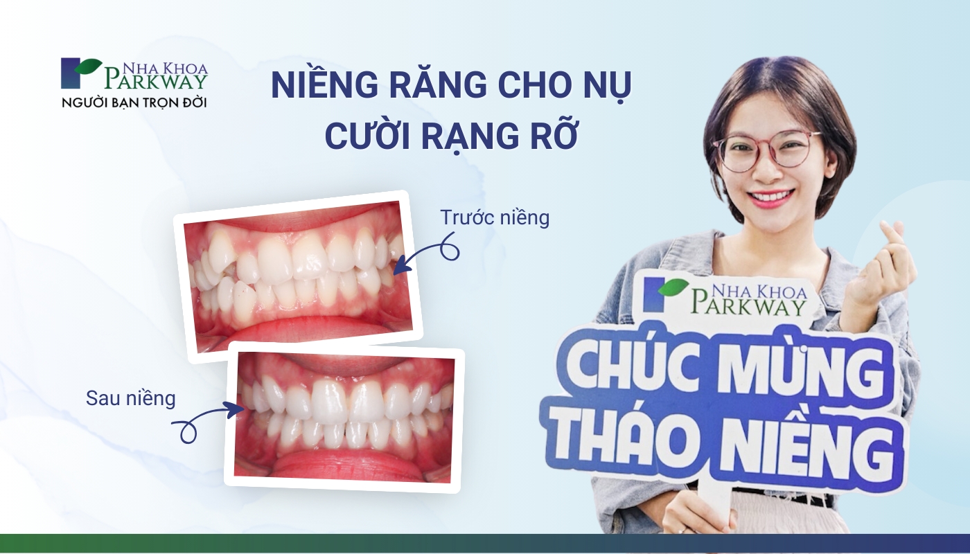 Hình ảnh khách hàng cười tươi rạng rỡ sau khi tháo niềng và hình ảnh trước - sau khi niềng