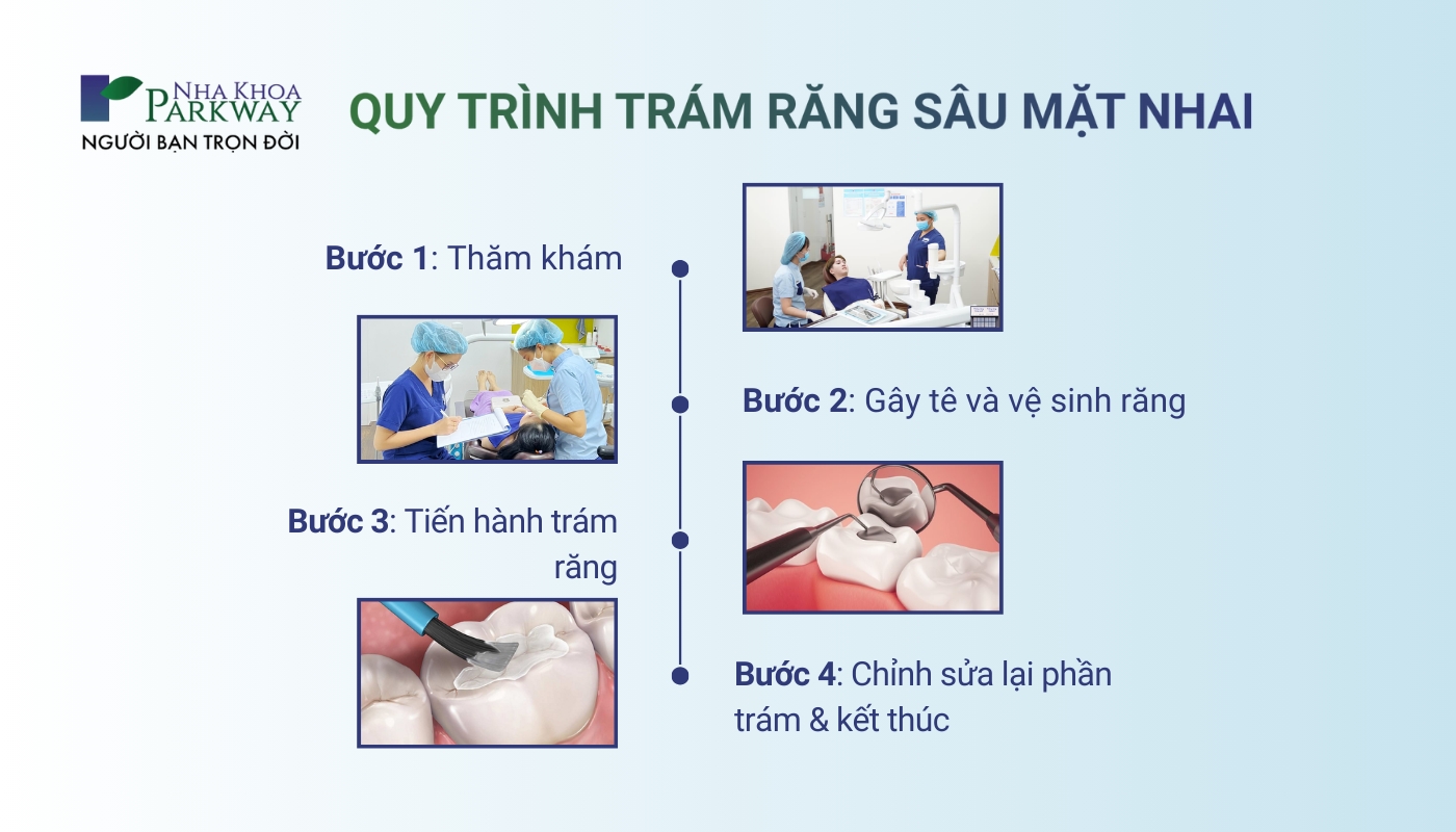 Quy trình trám răng sâu mặt nhai: thăm khám, gây tê và vệ sinh răng, tiến hành trám răng, chỉnh sửa lại phần trám và kết thúc