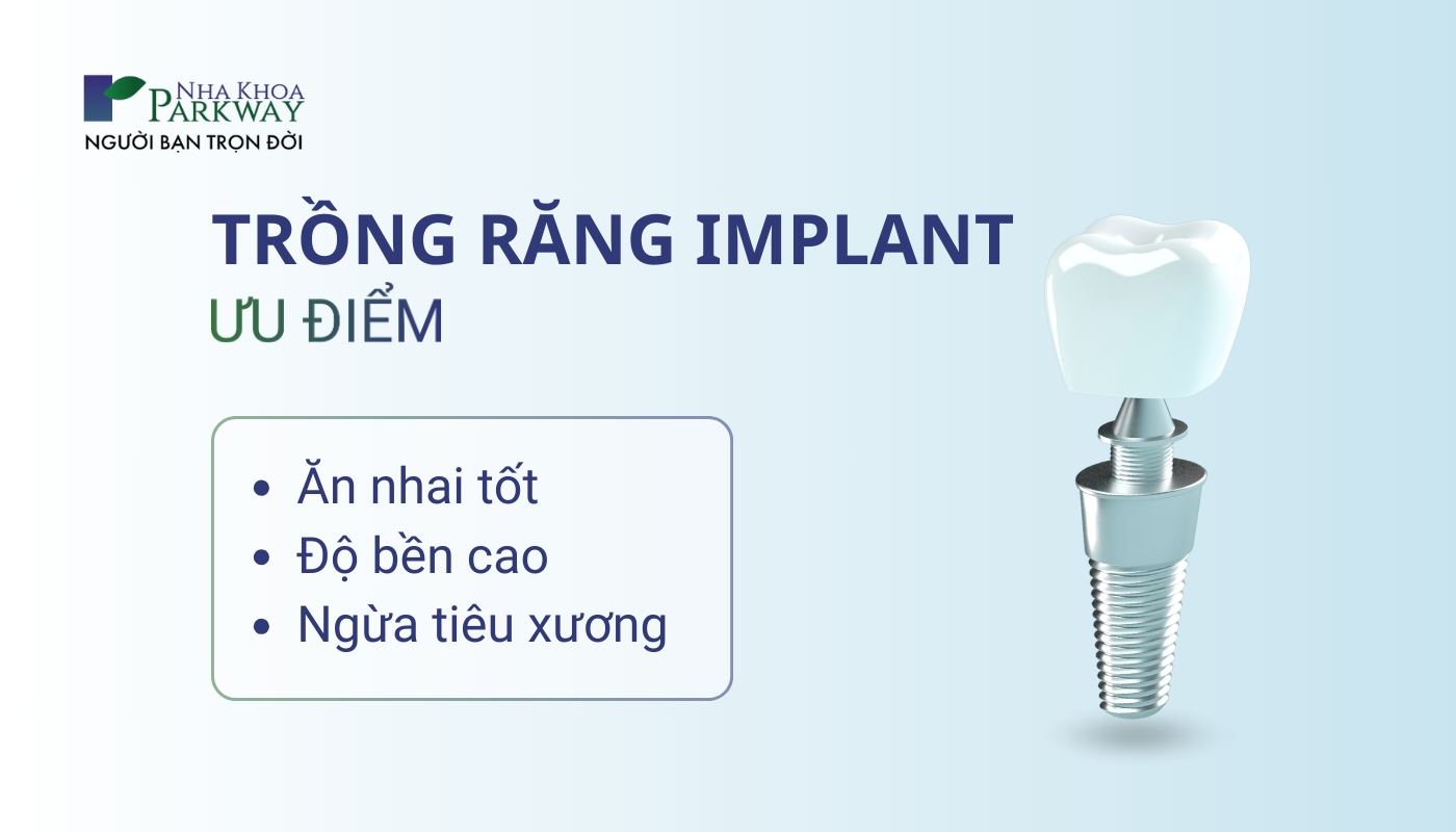 Ưu điểm trồng răng implant: Ăn nhai tốt, độ bền cao, ngừa tiêu xương
