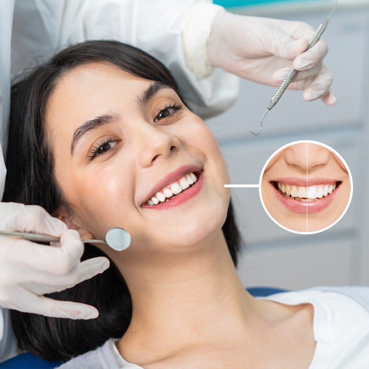 Hình ảnh khách hàng sử dụng dịch vị nha khoa thẩm mỹ , hiệu quả trước và sau